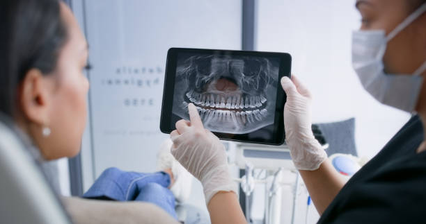 Licensed Teeth Whitening service in Sachse, TX - Smile Center Dentistry